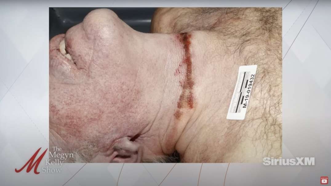 Jeffrey Epstein's Brother Reveals Evidence He Was Murdered, Dr. Hired To Observe Autopsy Agreed