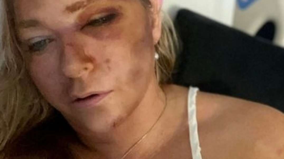 Epstein Victim Dies By 